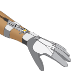 Product Development & OEM - Robotic Glove Rehabilitation Device
